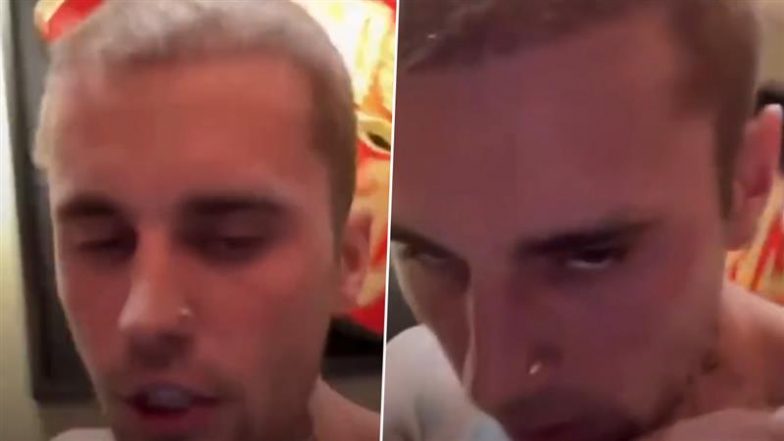 Justin Bieber Leaves Fans Worried in Yet Another Disturbing IG Live – WATCH