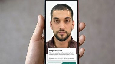 Business News | Cureskin to Launch World's First AI-Powered Hair Analyser to Combat Baldness on 20th April 2025