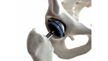 Business News | Hip Replacement Recovery: Q&A with a Hip Specialist