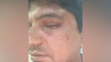 India News | Karnataka: Professor Alleges He Was Thrashed for Objecting to Littering in Bengaluru; Police Complaint Filed