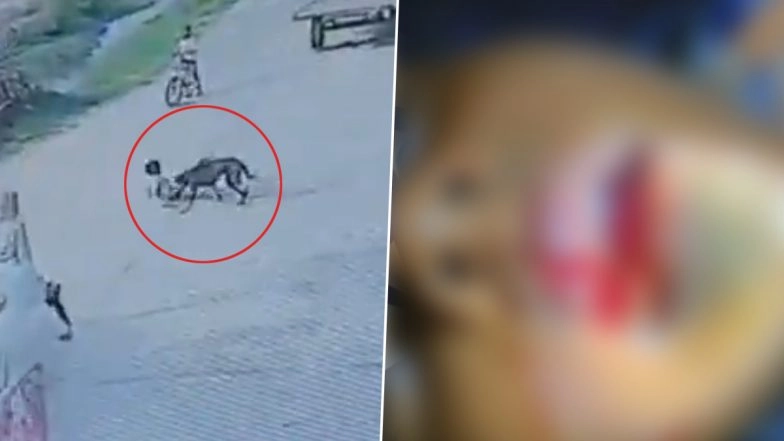 Dog Attack Caught on Camera in Meerut: 7-Year-Old Boy Suffers Serious Injuries After Stray Dog Attacks Him, Locals Kill Canine (Watch Video)