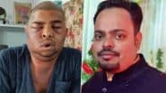 Dr Anushka Tiwari ‘Absconding’ After 2 Engineers Die Following Hair Transplant Treatment at Her Empire Clinic in Kanpur, Her Degree Under Scrutiny