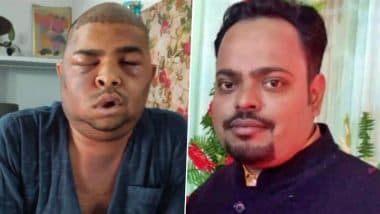 Dr Anushka Tiwari ‘Absconding’ After 2 Engineers Die Following Hair Transplant Treatment at Her Empire Clinic in Kanpur, Her Degree Under Scrutiny