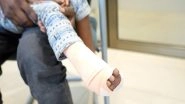 India News | Greater Noida: 4-year-old Girl Saved from Amputation After Neglected Injury