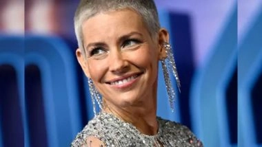 Entertainment News | Evangeline Lilly Shares Pictures of Gruesome Injuries She Sustained After Fainting