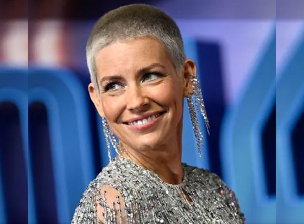 Entertainment News | Evangeline Lilly Shares Pictures of Gruesome Injuries She Sustained After Fainting