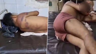 Hardoi Horror: Man Stripped Naked, Beaten With Hammer on Private Parts and Forced To Drink Urine by Girlfriend’s Family in UP; Police Respond As Video Goes Viral