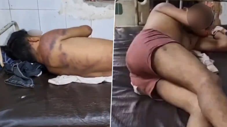 Hardoi Horror: Man Stripped Naked, Beaten With Hammer on Private Parts and Forced To Drink Urine by Girlfriend’s Family in UP; Police Respond As Video Goes Viral