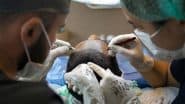 Hair Transplant Gone Wrong in Kochi: Kerala Man Battles Flesh-Eating Bacteria Following Procedure at Insight Derma Clinic, Undergoes 13 Surgeries