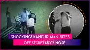 Kanpur: Man Bites Off Society Secretary&rsquo;s Nose in Parking Dispute, FIR Registered As Video Goes Viral