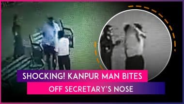 Kanpur: Man Bites Off Society Secretary’s Nose in Parking Dispute, FIR Registered As Video Goes Viral Kanpur: Man Bites Off Society Secretary’s Nose in Parking Dispute, FIR Registered As Video Goes Viral