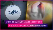 Dog Attack in Meerut: Stray Dog Mauls Boy, Chews Off His Upper Lip; Angry Villagers Kill Canine