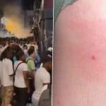 Syringe Attack in France: 145 People Pricked With Needle During Fete de la Musique Festival Across Multiple Cities Including Paris; 12 Arrested (See Pic and Videos)