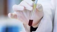 Gwada Negative: New Blood Group Discovered by Scientists in French Woman From Guadeloupe, Know All About the World’s 48th Blood Group System
