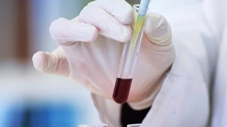 Gwada Negative: New Blood Group Discovered by Scientists in French Woman From Guadeloupe, Know All About the World’s 48th Blood Group System