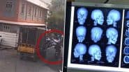 Bengaluru Shocker: Biker Suffers 12 Injuries to Skull, Dies After Tree Branch Falls on Him; Tragic Video Surfaces