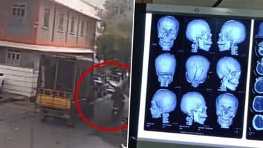Bengaluru Shocker: Biker Suffers 12 Injuries to Skull, Dies After Tree Branch Falls on Him; Tragic Video Surfaces