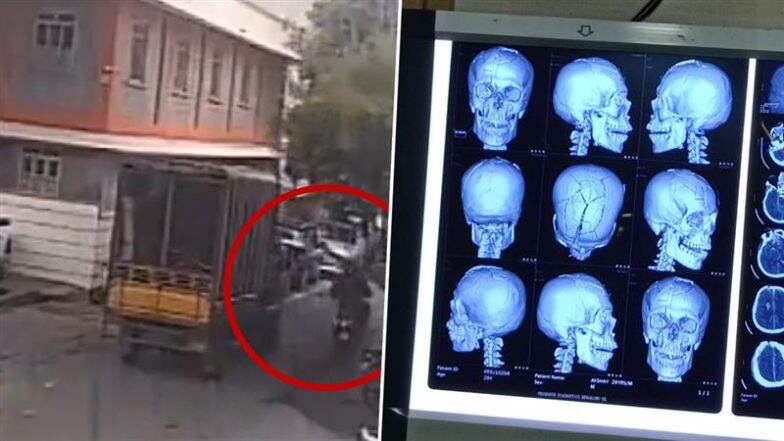 Bengaluru Shocker: Biker Suffers 12 Injuries to Skull, Dies After Tree Branch Falls on Him; Tragic Video Surfaces