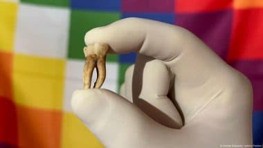 Secret Leprosy Infected the Americas Before European Arrival