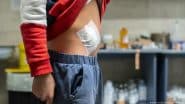 Appendix Cancer Rises in Young People — but Why?