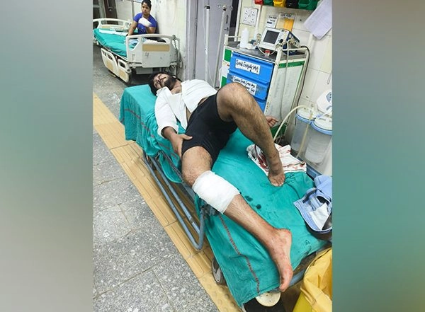 India News | Shooter from Kala Jatheri Gang Apprehended After Exchange of Fire in Najafgarh: Delhi Police