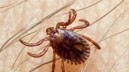 World News | Pakistan Reports Three Deaths from Congo Virus
