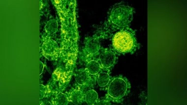 India News | Indigenous Rapid Detection Kit Ready to Detect Nipah Virus with 100% Accuracy: Director, ICMR-NIV