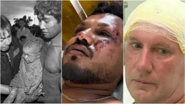 Notable Sole Survivors of Plane Crashes: Youngest, Oldest and World's Deadliest Air Disaster With a Sole Survivor!