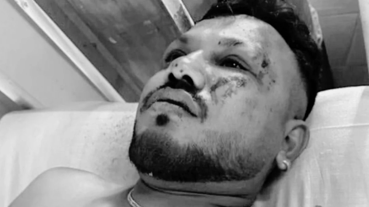 Vishwash Kumar Ramesh survived Air India Flight 171 crash, Deadliest accident with a sole survivor. 269 lives were lost.