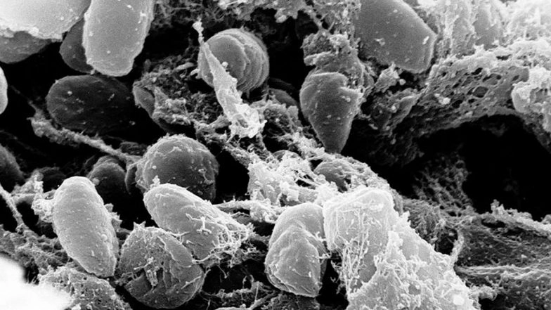 Plague in California: US Resident Tests Positive for Plague After Camping Trip to Lake Tahoe