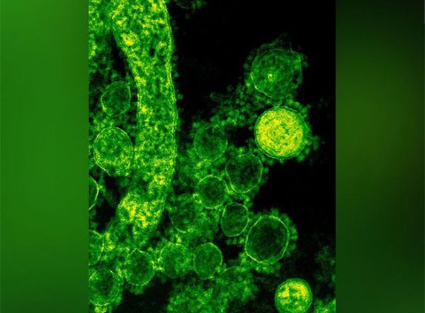India News | Nipah Virus Alert Issued in Three Kerala Districts After Two Suspected Cases