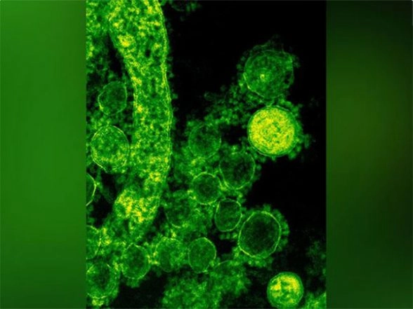 LatestLY - Business - News Image