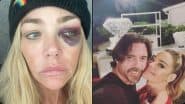 ‘You F****** B**** I Do Not Trust You’: Hollywood Actress Denise Richards Files Case of Domestic Violence Against Ex-Husband Aaron Phypers