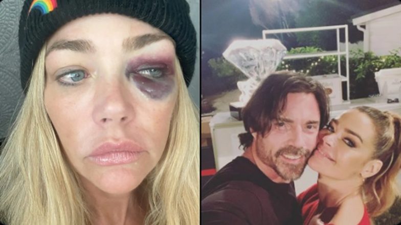 ‘You F****** B**** I Do Not Trust You’: Hollywood Actress Denise Richards Files Case of Domestic Violence Against Ex-Husband Aaron Phypers