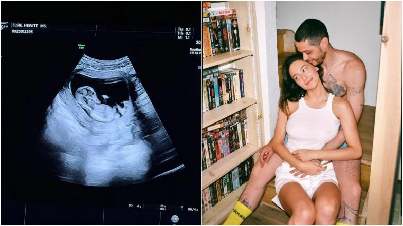 ‘Welp Now Everyone Knows We Had Sex’ Pete Davidson’s Girlfriend Elsie Hewitt Announces Pregnancy by Sharing Couple’s Photos on Instagram