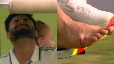 Rishabh Pant Injury Update: BCCI Issues Update As Wicketkeeper Retires Hurt After Chris Woakes’ Yorker Crashes Onto His Foot During IND vs ENG 4th Test 2025 (Watch Video)