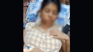 Kanpur Dog Attack: BBA Student Suffers Severe Facial Injuries, Gets 17 Stitches After Being Mauled by Stray Dogs; Disturbing Photo Surfaces