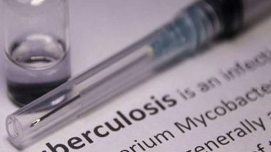 India News | Assam: Tezpur University Develop Low-cost, Smartphone-based TB Detection Device for Rural Areas