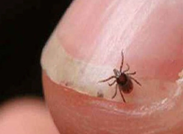 India News | Shimla: Three Test Positive for Scrub Typhus at IGMC