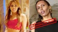 Fact Check: Miley Cyrus’ Emaciated Photo Goes Viral Again, With Singer’s Face in Unrecognisable Condition! Fake or Real? Find out Here!