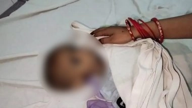 Madhya Pradesh Horror: 15-Month-Old Girl Dies of Malnutrition in Shivpuri; Mother Alleges In-Laws Prevented Treatment Because of Her Gender