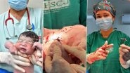 Brazil: Newborn Baby Holds Contraceptive IUD That Failed To Prevent Mother&rsquo;s Pregnancy in Neropolis, Video Surfaces