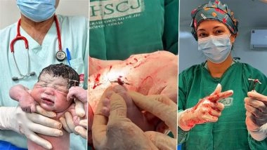 Brazil: Newborn Baby Holds Contraceptive IUD That Failed To Prevent Mother’s Pregnancy in Neropolis, Video Surfaces