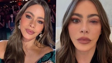 ‘Sorry I Had To Cancel’: Sofia Vergara Rushed to ER With ‘Craziest’ Eye Allergy Ahead of Emmy Awards 2025 (View Post)