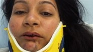 Indian-Origin Nikita and Karan aka &lsquo;The Kaleidoscope Couple&rsquo; Allege Brutal Racial Attack by Chinese Man During Honeymoon in Switzerland; Hotel Refutes Allegations (Video)