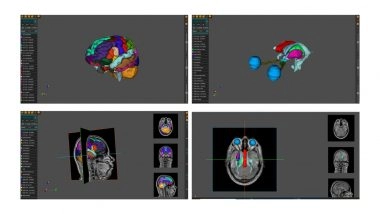 Business News | AnaVu: IIIT-Hyderabad's 3D Anatomy Visualization Platform Transforming Medical Education