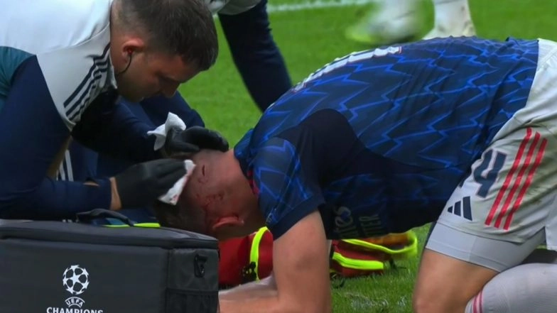 Viktor Gyokeres Suffers Nasty Head Injury After Clash With Teammate Gabriel Magalhaes During Athletic Club vs Arsenal UCL 2025-26 Match (Watch Video)