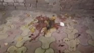 Acid Attack in Delhi: 20-Year-Old Woman Injured As Stalker Throws Acid on Her Near Laxmi Bai College in Ashok Vihar (Watch Videos)