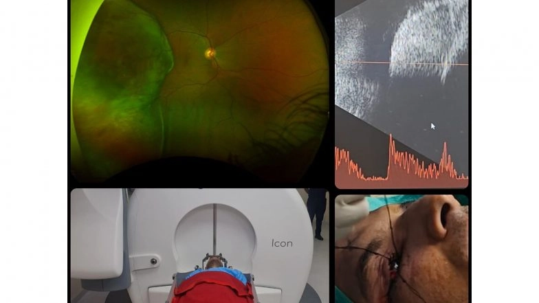 India News | Army Hospital Performs Gamma Knife Therapy on 38-year-old Serving Officer