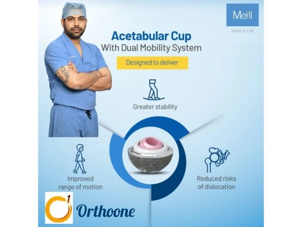 Business News | Modern Hip Replacement: Greater Stability and Longer Life with Dual Mobility and Ceramic Technology by Dr. Dibya Singha Das